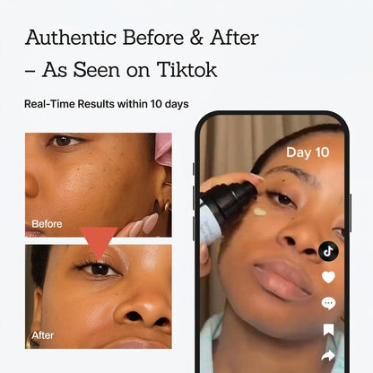 Retinal Skin Booster Serum